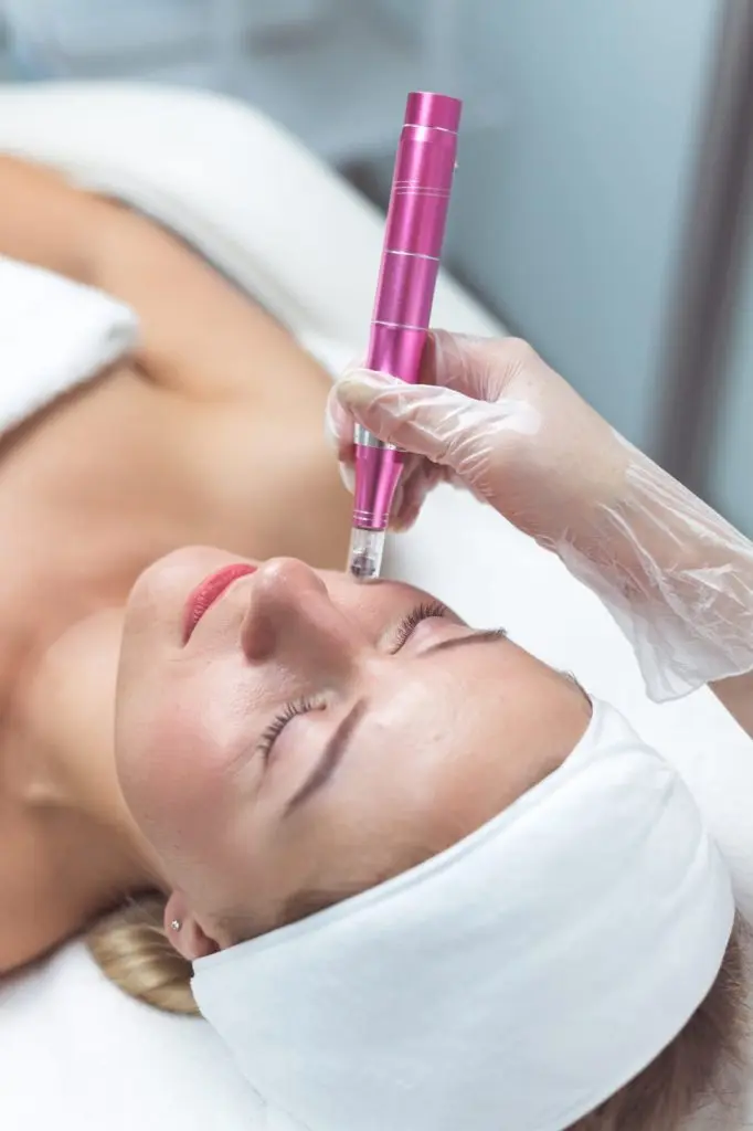 Microneedling